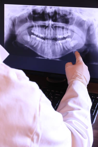 Best Emergency Tooth Extraction in Atlanta, GA