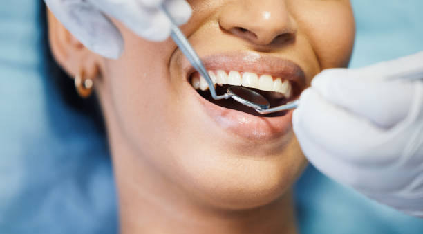 Best Emergency Tooth Extraction in Atlanta, GA